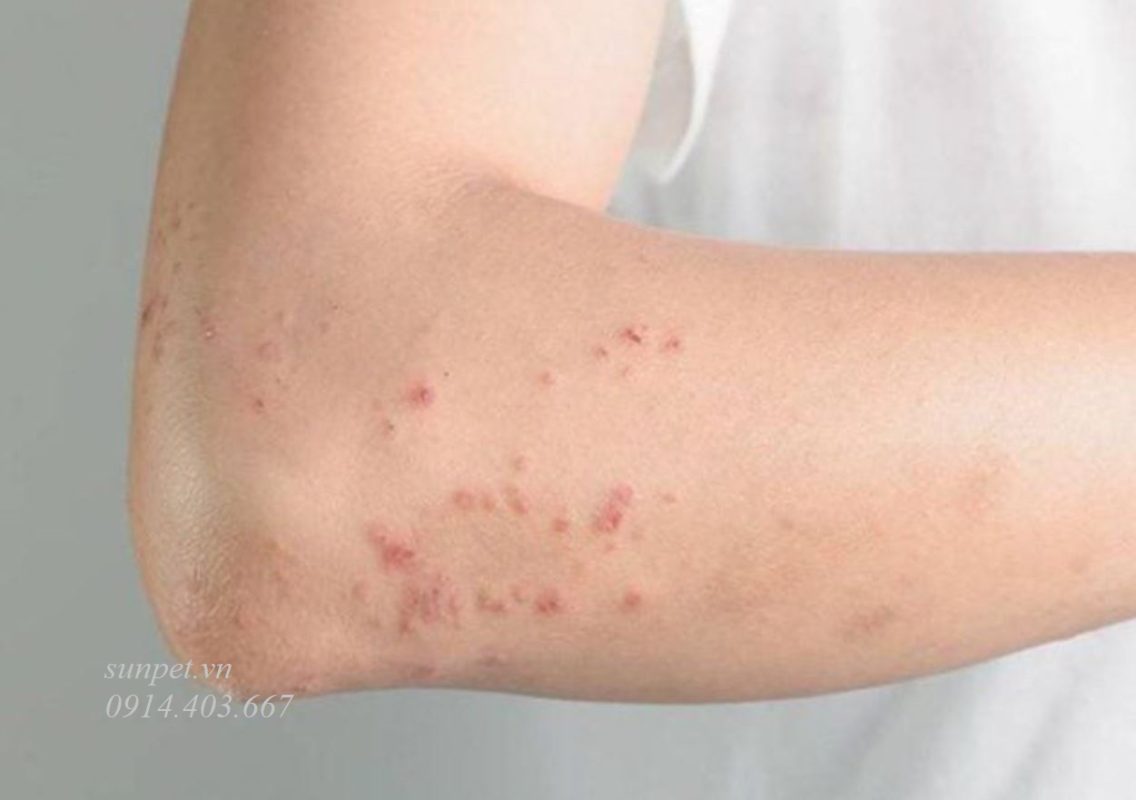 Trứng sán mèo và nguy cơ lây nhiễm cho người